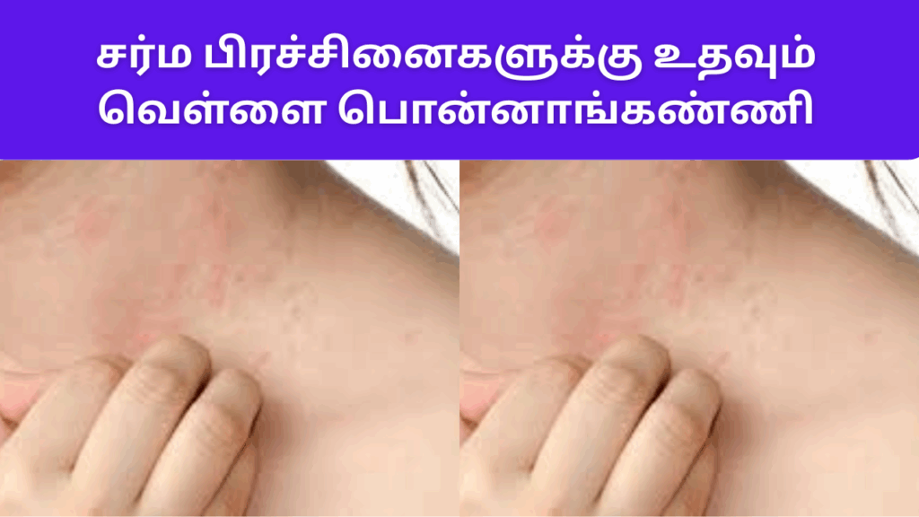 வெள்ளை பொன்னாங்கண்ணியின் பயன்கள் | Vellai ponnanganni benefits in tamil 1 Vellai ponnanganni benefits in tamil